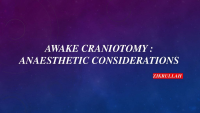 Awake craniotomy anesthesia consideration (1).pptx